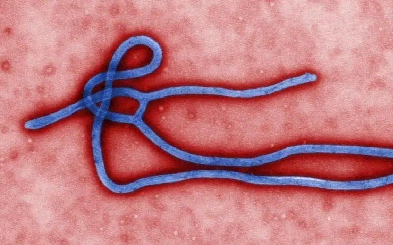 Ebola Virus